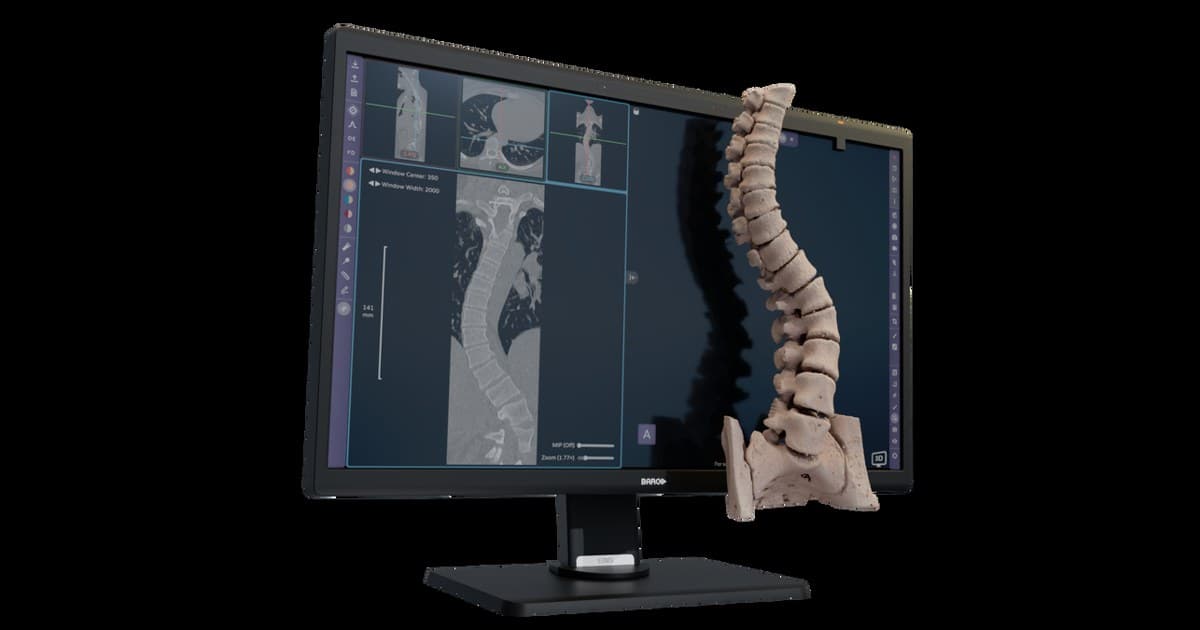 Avatar Medical Obtains CE Marking for Avatar Medical Vision, a First for Software Compatible with a Glasses-Free 3D Medical Display